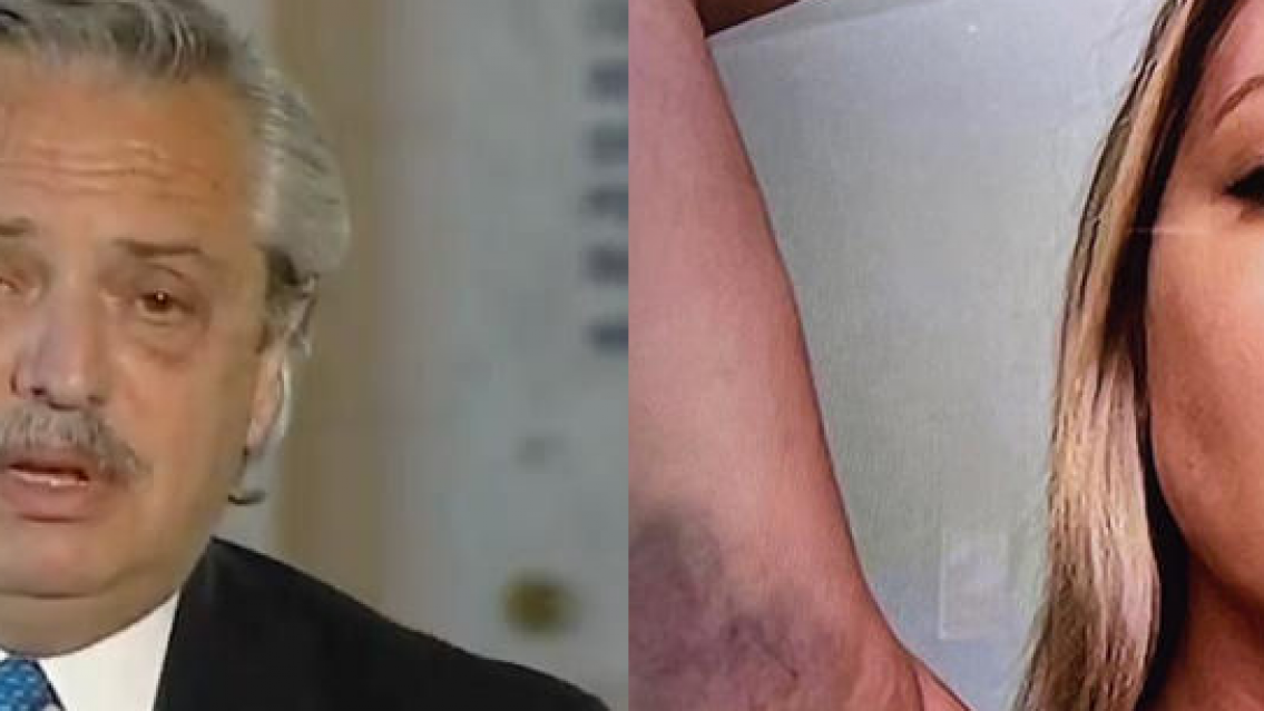 "Est�s muy lastimada", las capturas que incriminan a Alberto Fern�ndez