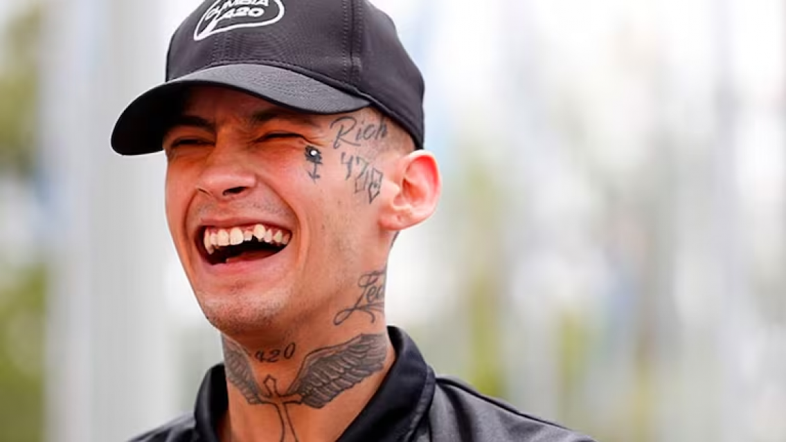 Qued� igualito a Enzo Fern�ndez, L-Gante se oper� los dientes