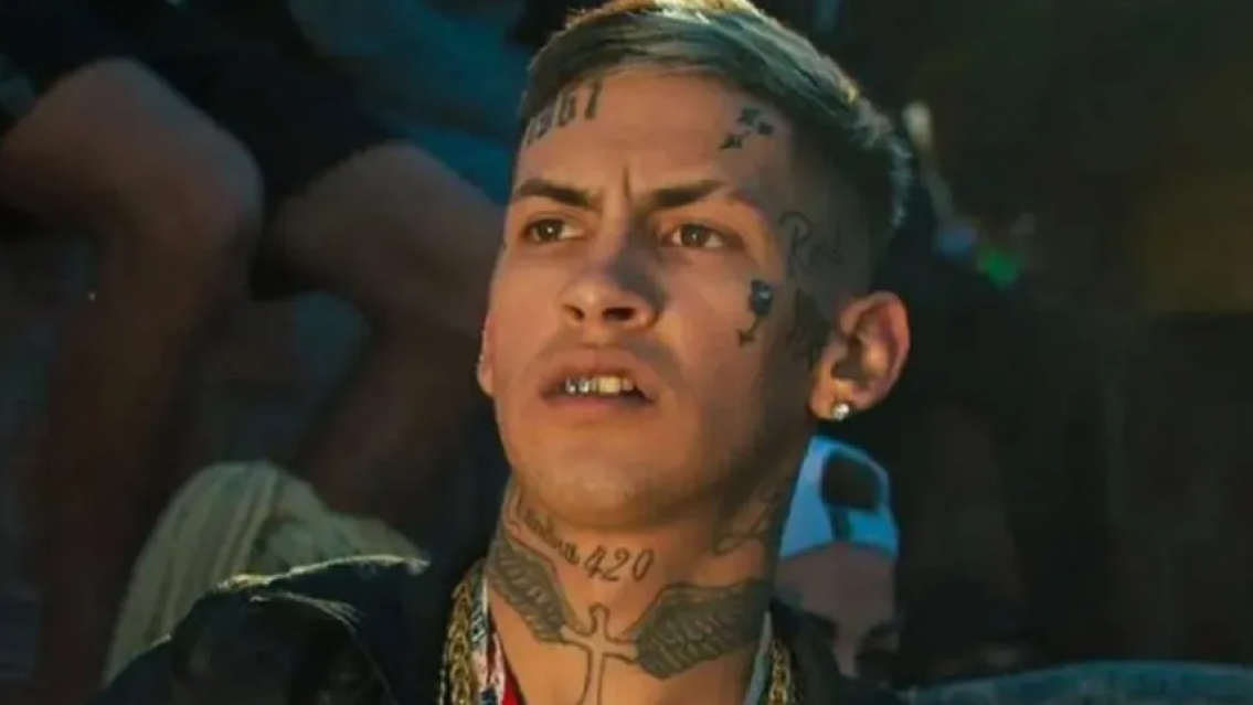 Tremendo cambio: L-Gante se cambió toda la dentadura y mostró cómo quedó su nueva boca