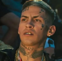 Tremendo cambio: L-Gante se cambi&oacute; toda la dentadura y mostr&oacute; c&oacute;mo qued&oacute; su nueva boca