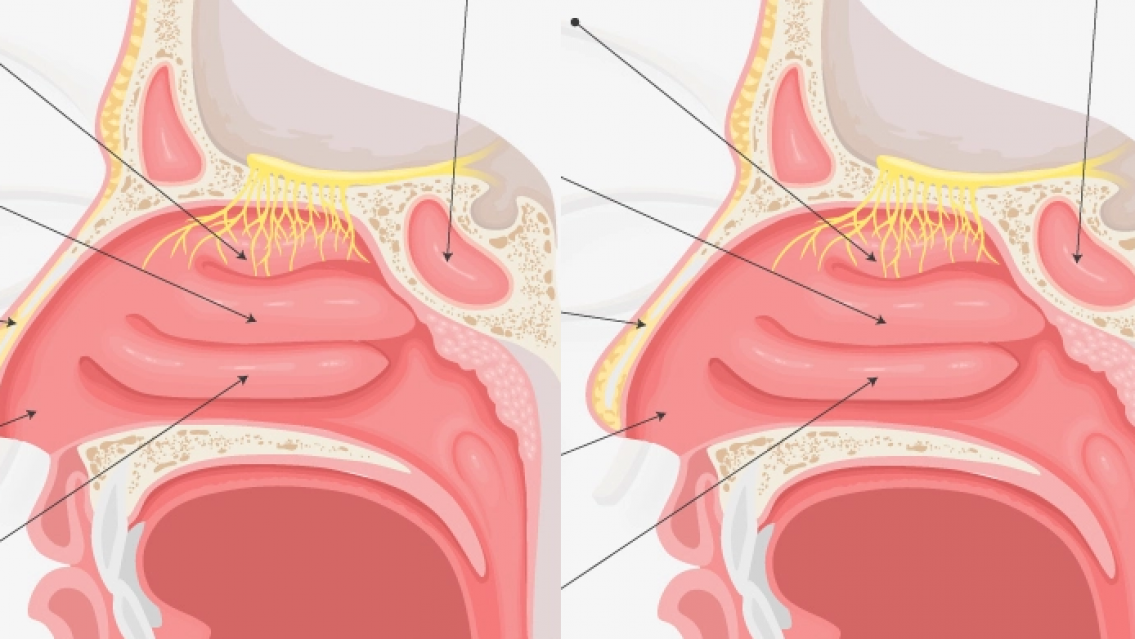 "Ingresó a mis fosas nasales", la droga que habría usado Marley contra su víctima