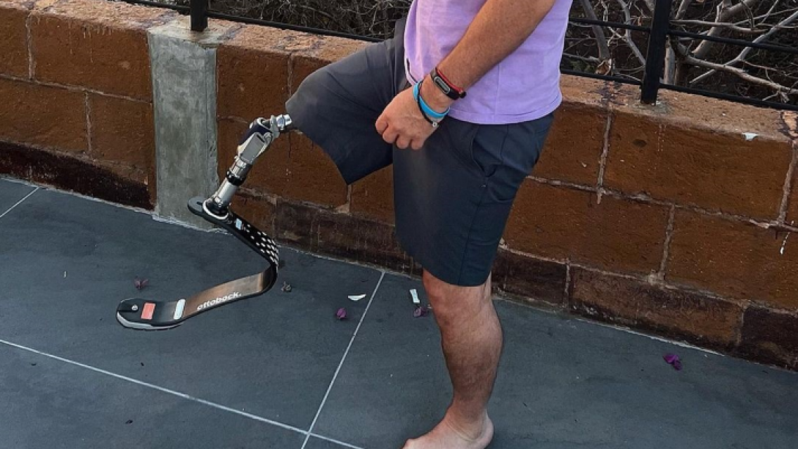 Le dol�a la panza, fue al hospital y le terminaron amputando una pierna. �C�mo pas�?