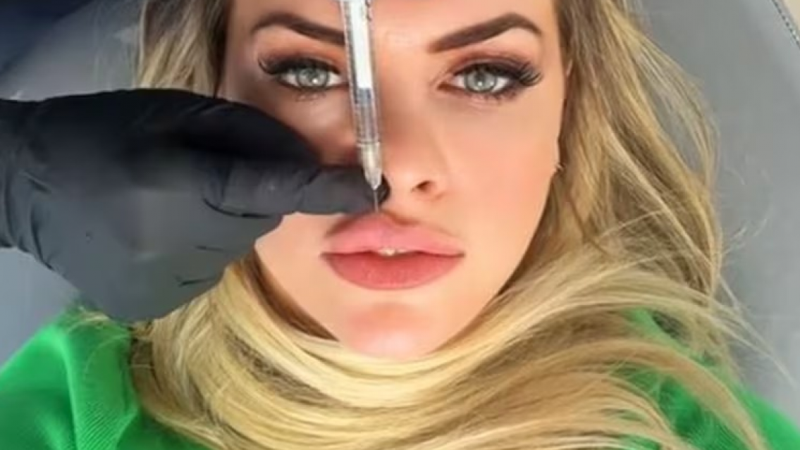 Alejandra Maglietti contó cómo usa el ácido ialurónico