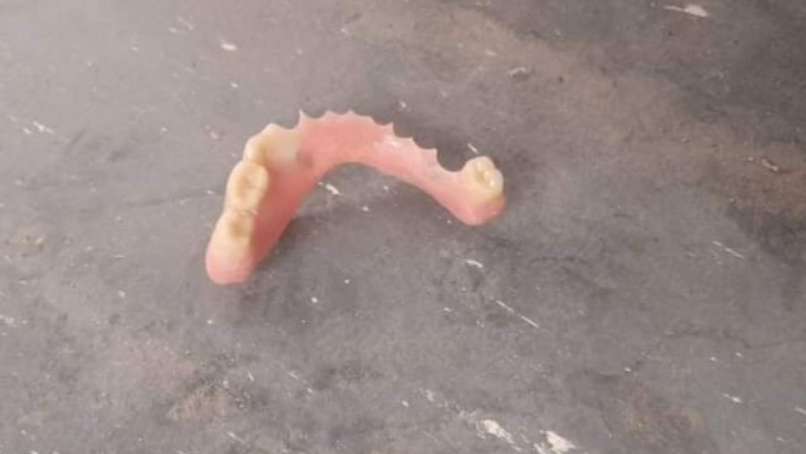 Colectivero jujeño encontró unos dientes: buscan a la abuela que los perdió