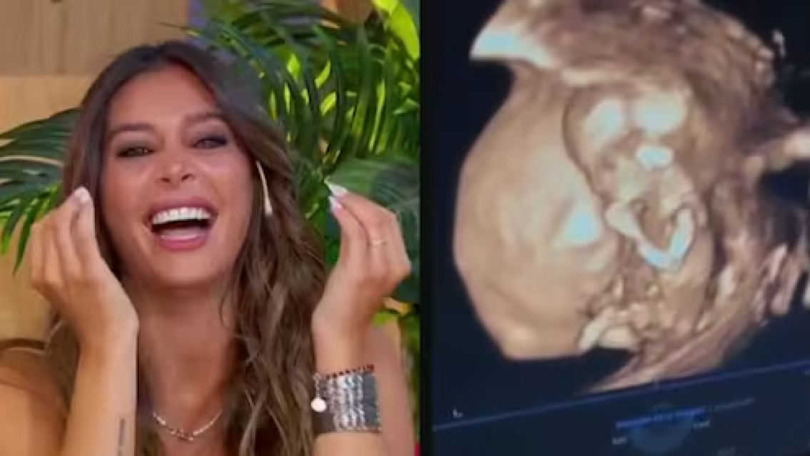Sol P�rez est� embarazada y este curioso detalle de su ecograf�a llam� la atenci�n 