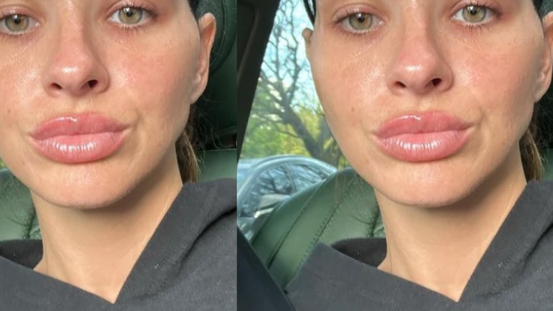 El retoque en la cara que se hizo la China Su�rez, le qued� "raro"