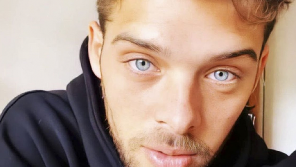 Santi Maratea sin dientes, ¿qué le pasó? Sorprende verlo así