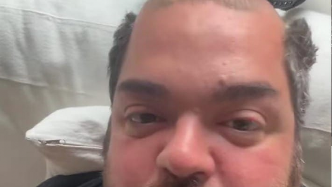 A Darío Barassi se le cayó la gorra y está totalmente pelado