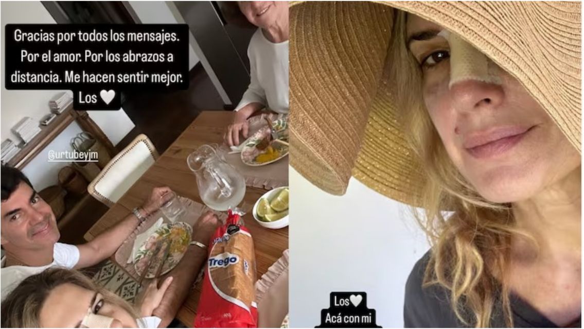 El fuerte accidente que sufri� Macedo: la foto que alarm� a varios