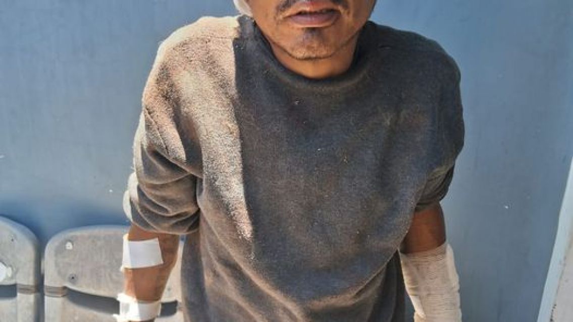 Dogo argentino destruyó a un ladrón en Alto Comedero y lo dejó en el hospital