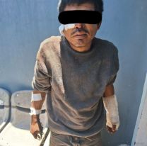 Dogo argentino destruyó a un ladrón en Alto Comedero y lo dejó en el hospital