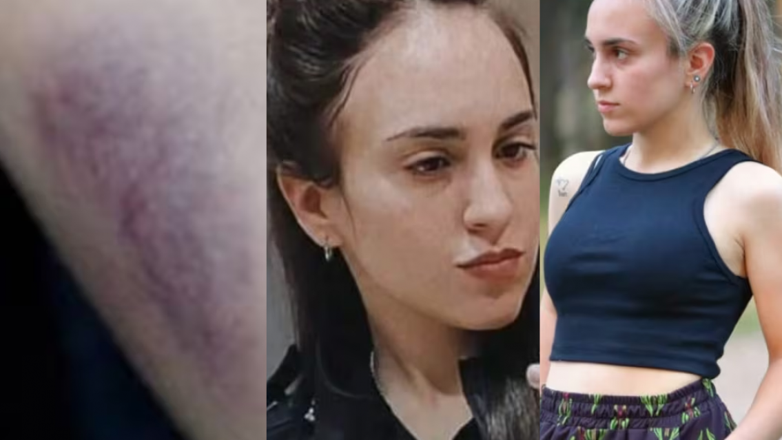 "¿Y ese moretón?" Repudian lo que pasó con una oficial de 21 años que murió