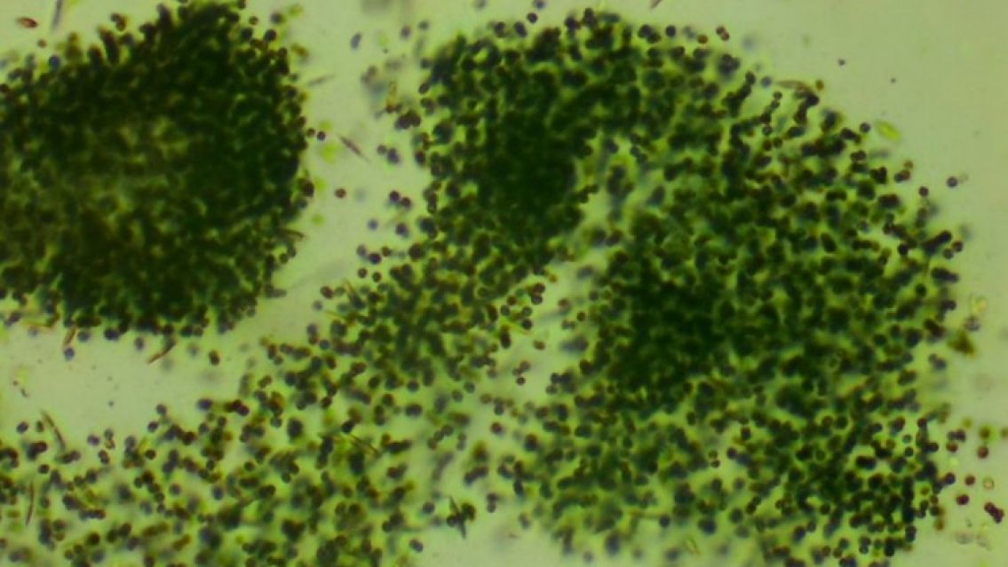 Alerta por cianobacterias en el dique Los Alisos de Jujuy: �Qu� tan t�xicas son?