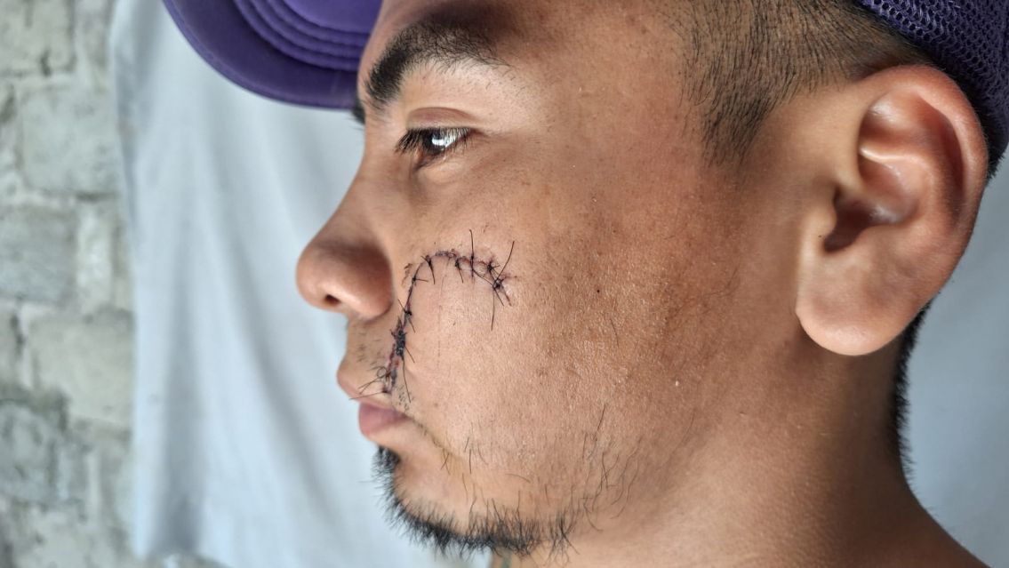 Brutal agresión en Av. Juan José Paso dejó a una persona gravemente herida