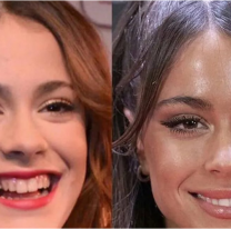 ¿Falta de ética? La cirujana de Tini Stoessel habló de los retoques que le hizo