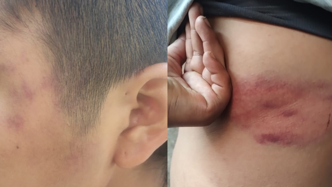 "Le rompieron el labio a mi hijo de 1 año", jujeña denuncia abuso de autoridad