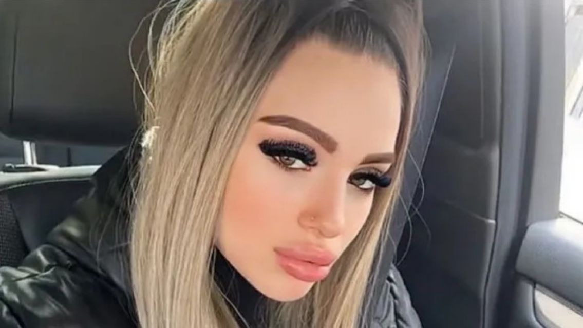 Atropell� a un nene de 8 a�os con un cuatriciclo y se defendi�: "Quieren lucrar con mi nombre"