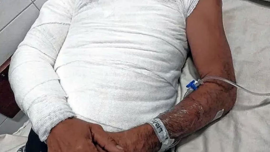 No se puede creer: discutieron por "la mayonesa", se calent� y lo prendi� fuego