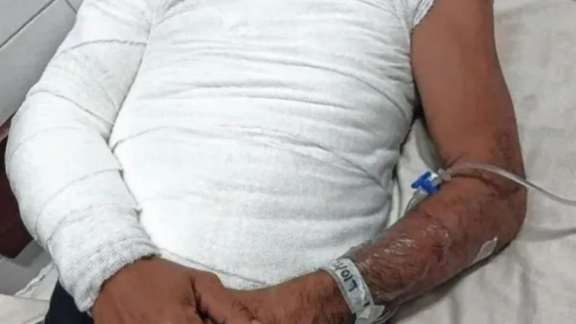 Dos hermanos se pelearon por un sachet de mayonesa y uno termin� internado