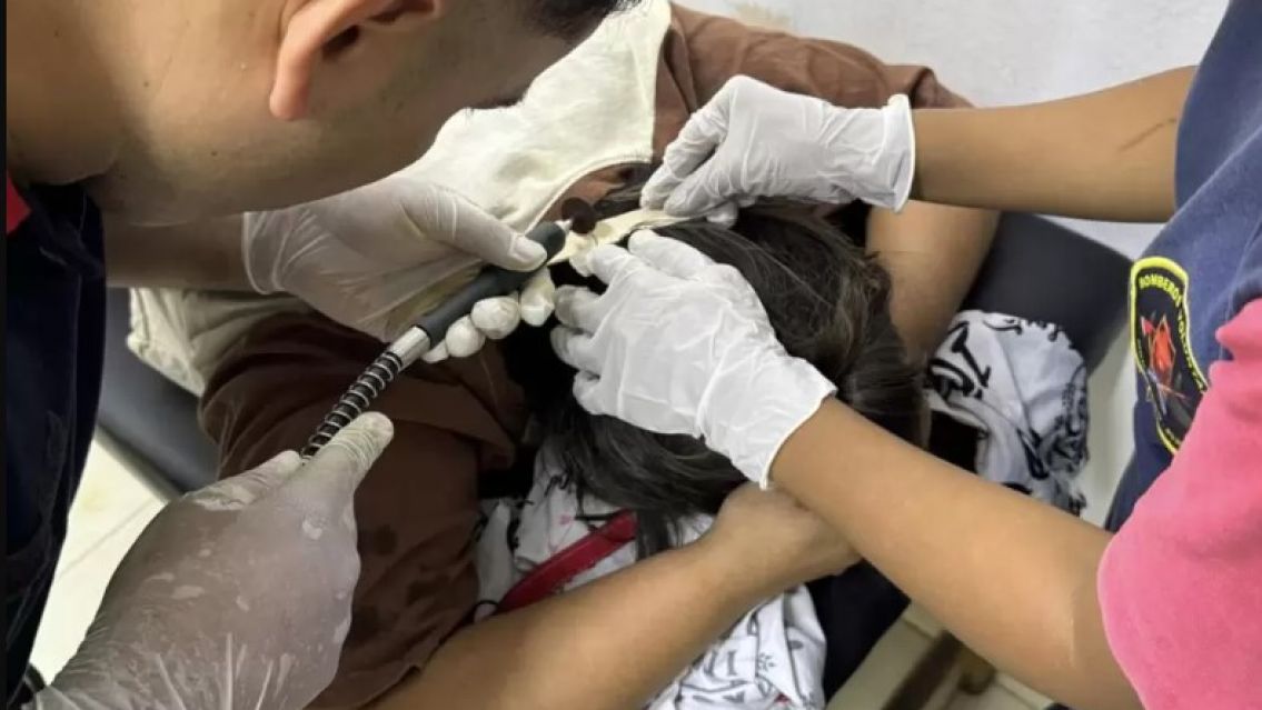 Juje�a ten�a algo incrustado en la cabeza: no lo pod�an creer cuando lo vieron