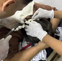 Jujeña tenía algo incrustado en la cabeza: no lo podían creer cuando lo vieron