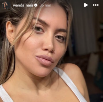 Wanda Nara se hartó de las especulaciones sobre su salud y mostró su tratamiento