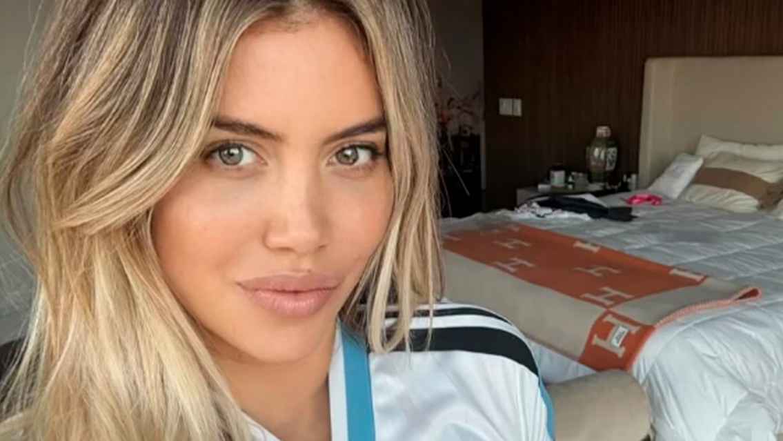 Así quedó Wanda Nara tras su último "retoque estético"