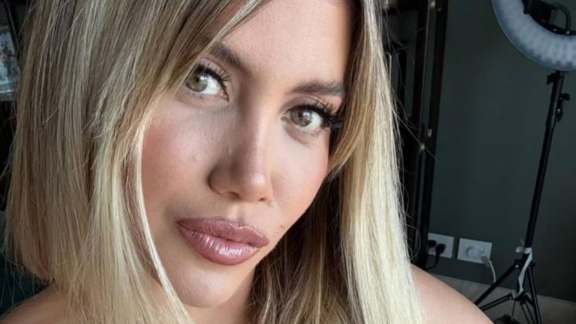 Wanda Nara mostr� el resultado de su operaci�n y recibi� comentarios terribles