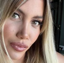 Wanda Nara mostró el resultado de su operación y recibió comentarios terribles