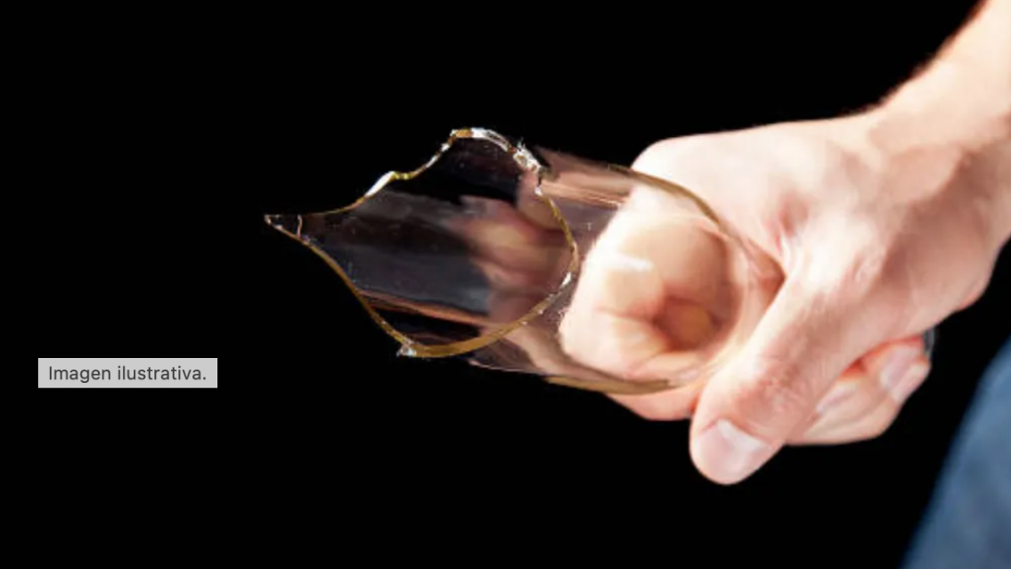 Apuñalaron a un hombre en la cara por negarse a comprar unas zapatillas en Jujuy