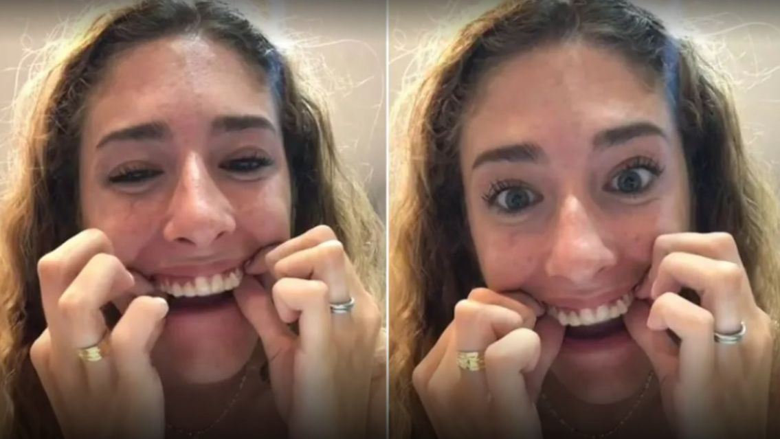 Intent� sacarse la contenci�n de los dientes y termin� de la peor manera
