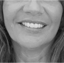 Muri&oacute; una empresaria tras una operaci&oacute;n est&eacute;tica: "Desde el segundo d&iacute;a..."