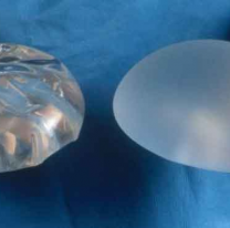 Empleado de una clínica robó implantes mamarios y dijo que "eran para su novia"