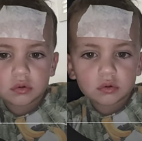 Así quedó el hijito de Mica Viciconte y Fabián Cubero tras la terrible caída