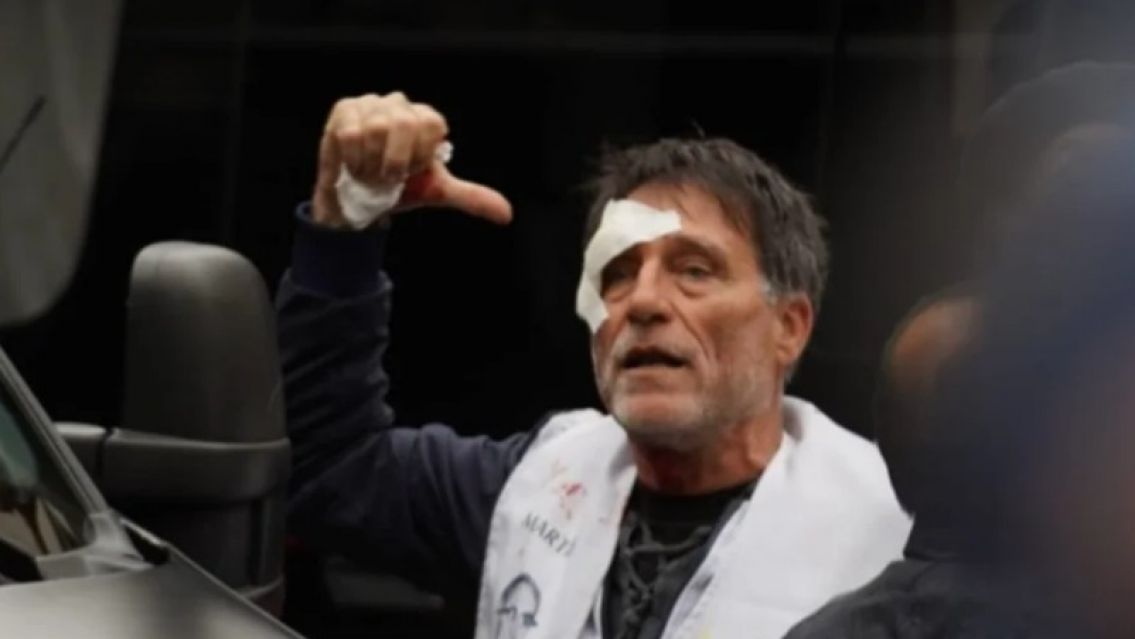 Brutal represi�n en el Congreso: Hay jubilados y un sacerdote herido