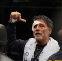 Brutal represión en el Congreso: Hay jubilados y un sacerdote herido