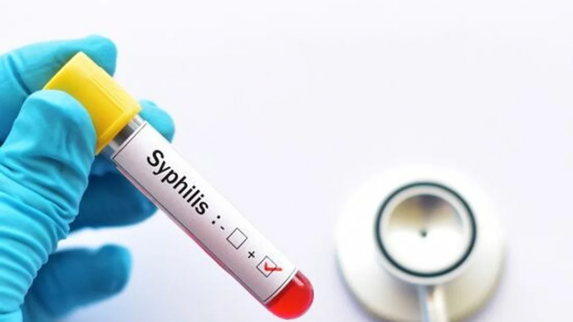 Alerta por Sífilis en Argentina: se triplicaron los casos en bebés recién nacidos