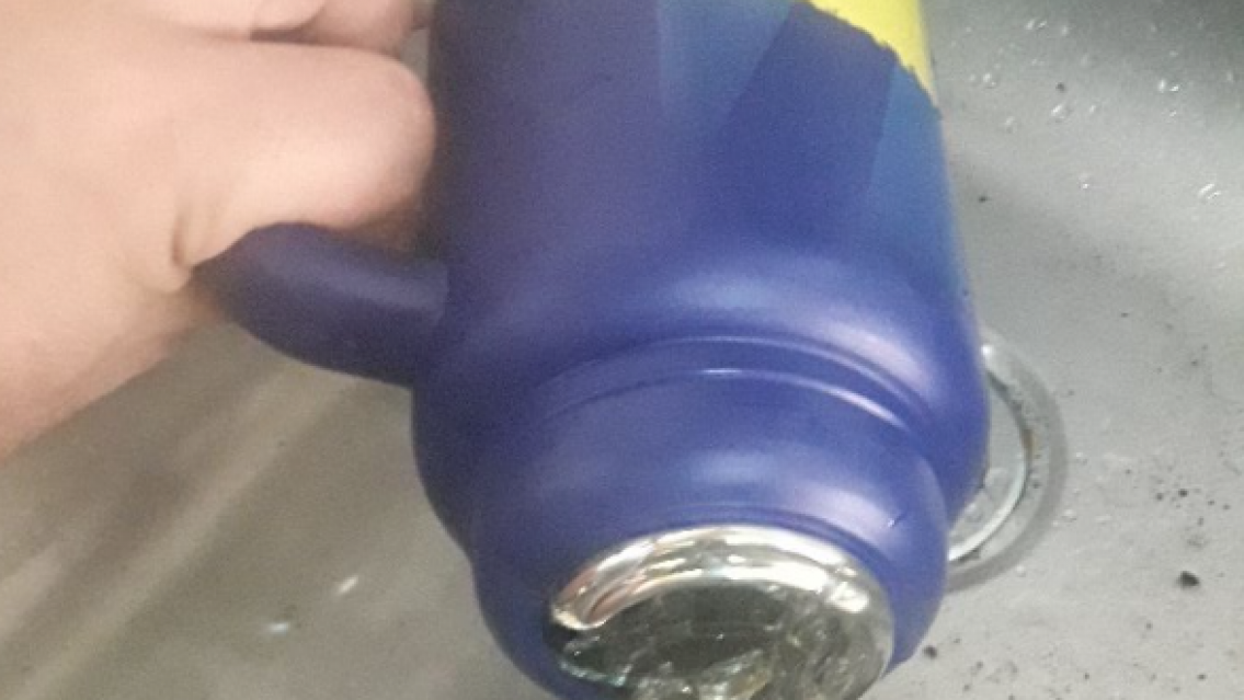 Bebé jujeño sufrió quemaduras con agua caliente y quedó internado