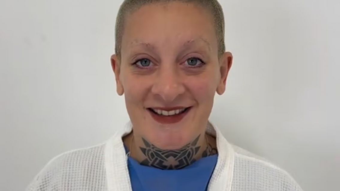 Furia se oper� y mostr� c�mo le qued�: todos se sorprendieron con el resultado