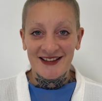 Furia se operó y mostró cómo le quedó: todos se sorprendieron con el resultado