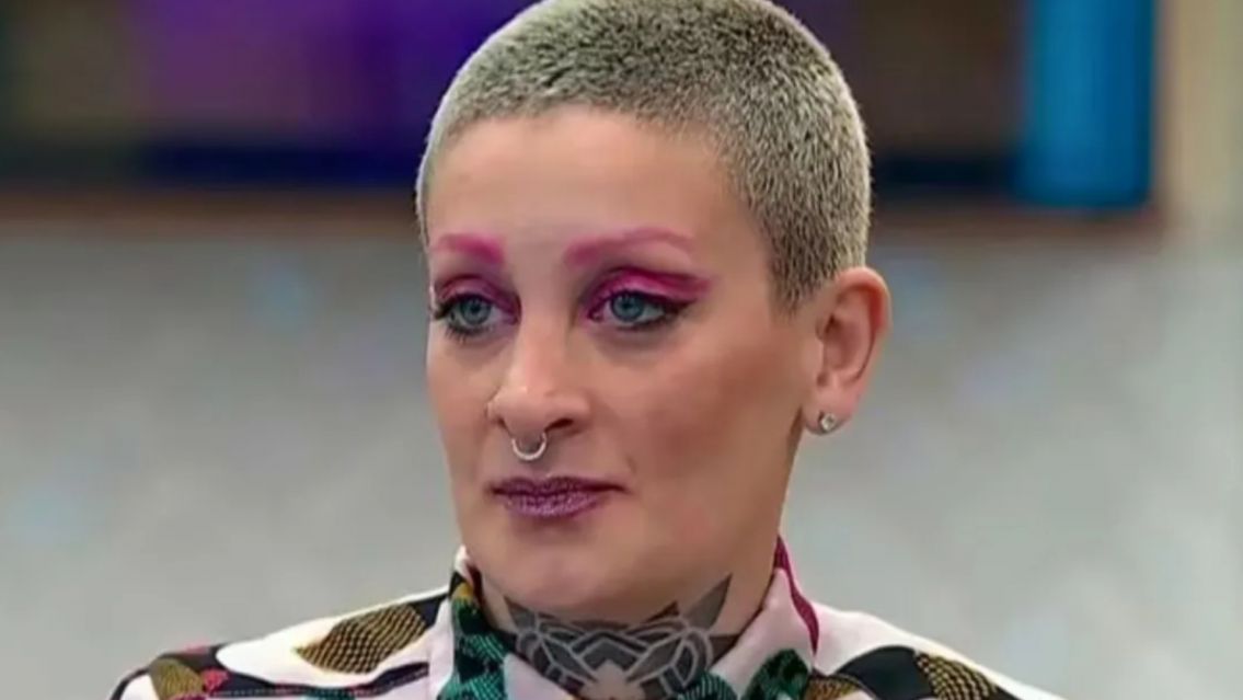 El terrible problema que tiene Furia tras su operación: "No puedo..."