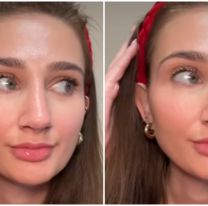 Se operó la nariz y tras salir de cirugía le dio la peor noticia al marido: "Ingrata"