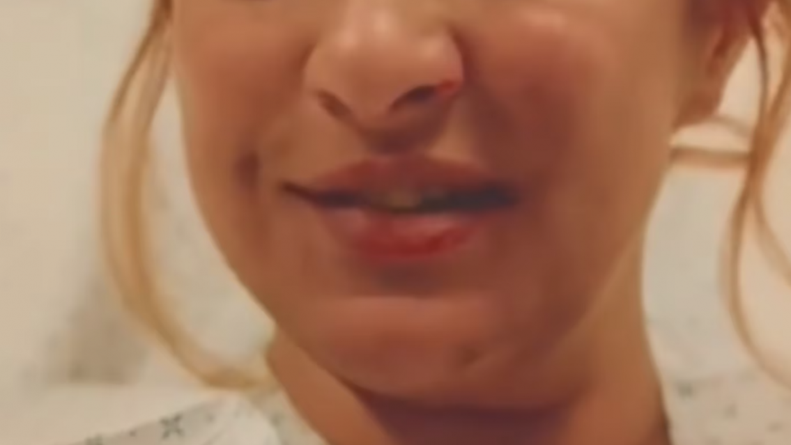 "Me prendí fuego": periodista argentina tuvo un accidente y vivió para contarlo