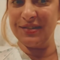 "Me prendí fuego": periodista argentina tuvo un accidente y vivió para contarlo