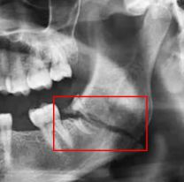 Juje&ntilde;o enloqueci&oacute; y le rompi&oacute; la mandibula a su ex: Qued&oacute; internada