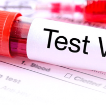 "Día Nacional de la Prueba del VIH", gran jornada en Alto Comedero