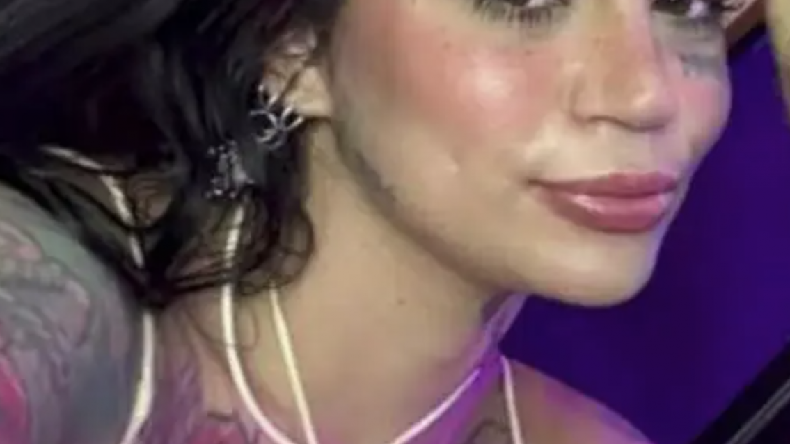 Joven y hermosa cantante se someti� a cirug�a est�tica y muri�