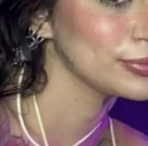 Joven y hermosa cantante se sometió a cirugía estética y murió