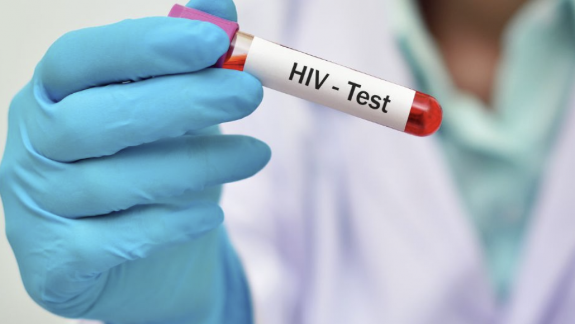 Testeos gratuitos de VIH en Alto Comedero esta semana