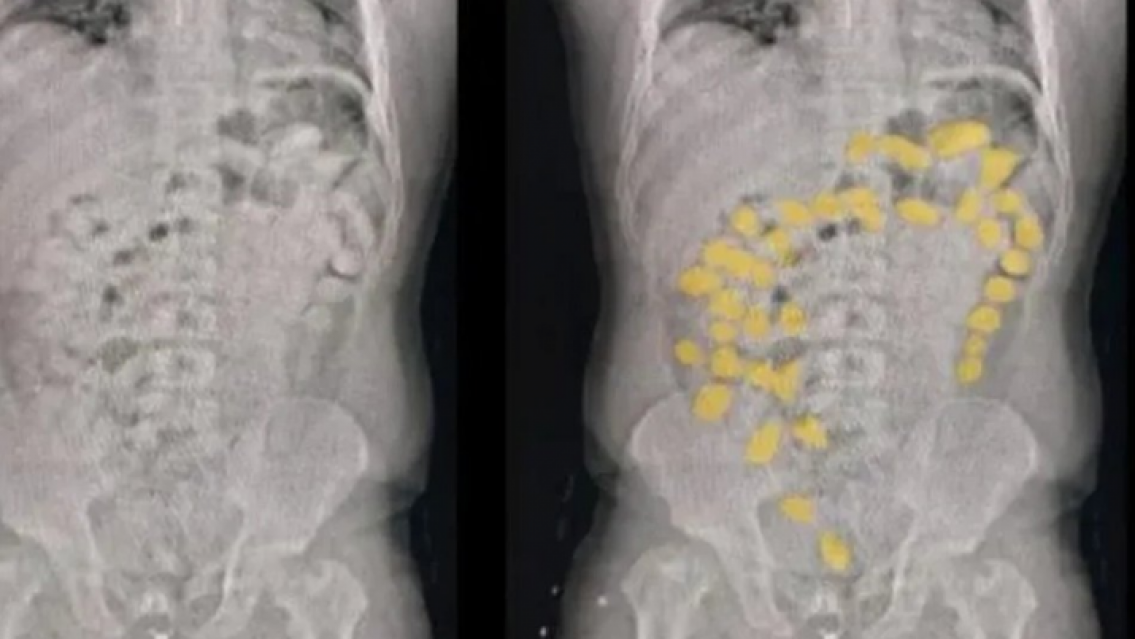 Operativo: se pusieron nerviosos en un control y descubrieron que eran "mulas"